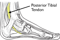 Foot & Ankle Pain Running: Common Causes & Treatment