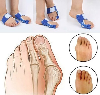 bunion corrector for shoes