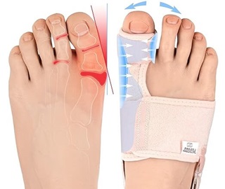 Bunion Splint: Find The Best Style For You - Foot Pain Explored