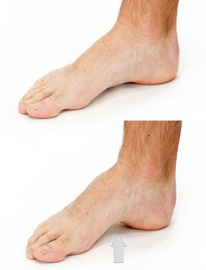stretching foot arch
