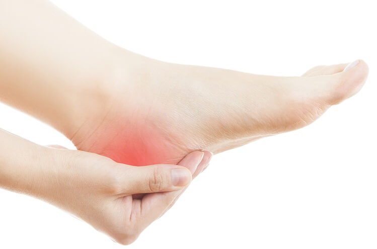 Home Remedies for Heel Pain and the Plantar Fascia