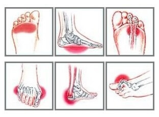 Common Foot Pain Symptoms and what they mean
