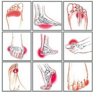 painful feet