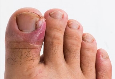 Tender Toe? Reasons Why Your Toe Hurts