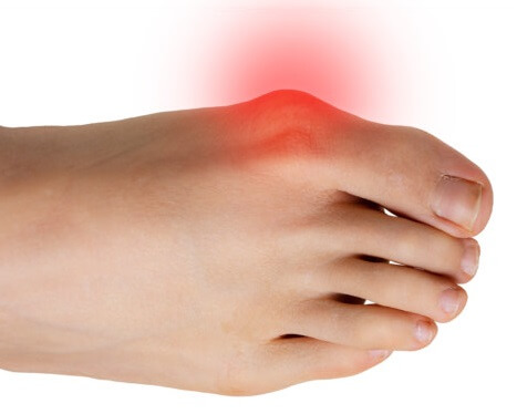 pain on side of heel bone