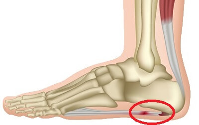 pain under foot and heel