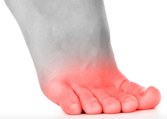 Foot Pain Diagnosis What s Causing Your Pain 