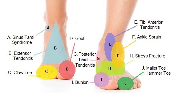foot pain front of heel