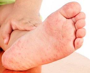 Common Causes of Foot Pain - Foot Pain Explored