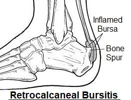 Heel muscles diagram